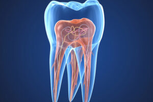 Todo lo que no sabías sobre la endodoncia.